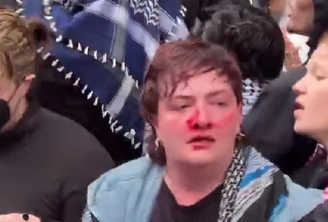 Ativista é agredida com soco de policial durante manifestação em Berlim