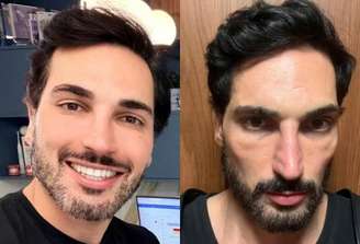 Antes e depois de Lucas Estevam.