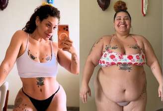 Ex-'The Voice' impressiona ao mostrar resultado de abdominoplastia após perder 90 kg; veja
