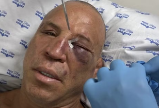 Wanderlei Silva mostrou resultado da luta com Popó