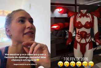 Influenciadora mostrou ferida nas mãos nos stories 