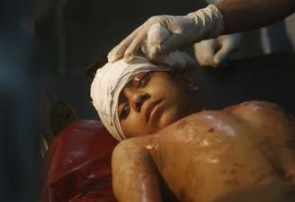 Criança é medicada após ser atingida por bomba em Peshawar