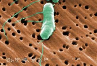 <p>Bactéria vibrio vulnificus pode comer a carne humana, a partir do momento de infecta uma pessoa</p>