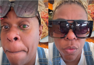 Cacau Protásio mostrou que desenvolveu uma lesão ocular depois de usar uma pomada capilar e gravar no mar