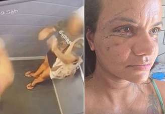 Juliana Soares mostra como está o rosto após cirurgia de reconstrução