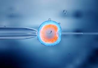 Imagem representativa de fertilização in vitro