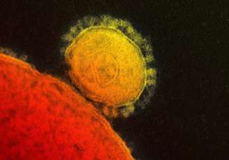 <p>Ainda de acordo com McDonald, o vírus corona recebe este nome por possuir superfície rugosa, cheia de picos, semelhante a uma coroa, explica o porta-voz do CDC americano</p>