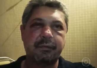 Brasileiro foi alvo de xenofobia e agressão em Portugal