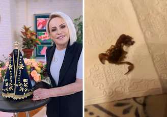 Ana Maria Braga | Escorpião que a picou