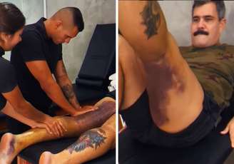 Juliano Cazarré se submete a fisioterapia após cirurgia