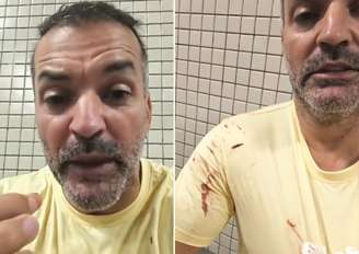 Pai afirma que filha de 14 anos foi atingida por bala perdida em Réveillon de Copacabana