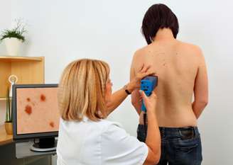 Segundo o médico responsável, ir ao dermatologista com frequência pode facilitar o tratamento do melanoma
