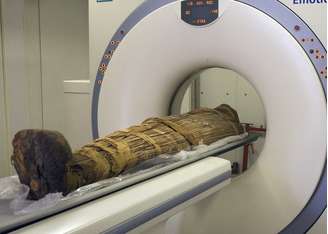 Pesquisadores fizeram exame de ressonância magnética em mais de 100 múmias de até 4 mil anos