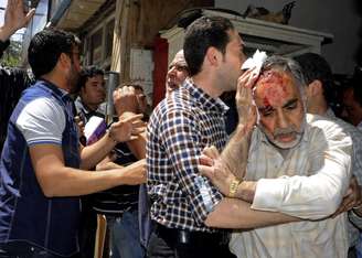 Homem ferido deixa prédio afetado pela explosão, em Damasco