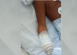 Menor de 8 anos ficou gravemente ferido