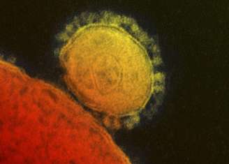 <p>Vírus causador da Síndrome Respiratória do Oriente Médio é visto em micrografia eletrônica do Instituto Nacional de Alergia e Doenças Infecciosas dos EUA</p>