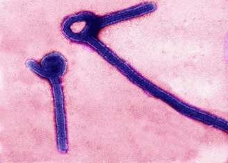 <p>Partículas do vírus Ebola em imagem de microscópio divulgada por laboratório das Forças Armadas dos EUA</p>