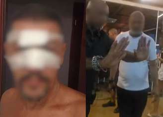 Homem foi agredido na noite de sábado, 10, em um quiosque na Avenida Presidente Castelo Branco, em Praia Grande.