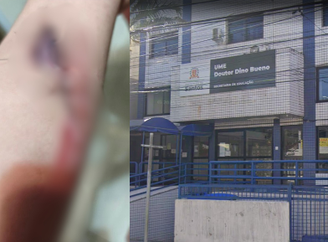 Criança levou 13 pontos no braço após incidente