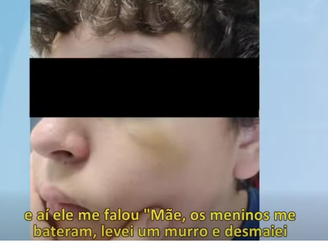 Menino brasileiro de 13 anos foi agredido em escola em Portugal