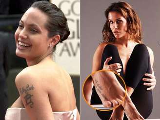 Celebridades brasileiras e internacionais já enfrentaram procedimentos diferentes para eliminar tatuagens indesejadas