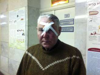 <p>Homem foi socorrido após ser atingido por estilhaços de vidro na região de Urals</p>