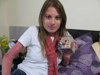 Jovem visitará Santa Maria pela primeira vez após o incêndio, para participar de uma homenagem ao namorado