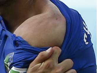 <p>Chiellini mostra o ombro mordido por Luis Suárez na partida entre Uruguai e Itália</p>