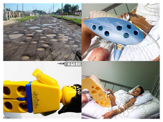 Memes zoam com perna de Urach 