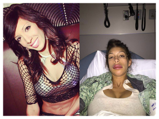 Farrah Abraham fica irreconhecível após cirurgia 