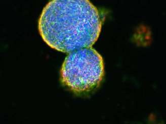 Células-tronco de embriões podem ajudar, no futuro, a medicina regenarativa