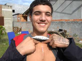 Jovem escapa da morte após ter prego cravado no peito: 'Foi um milagre' 