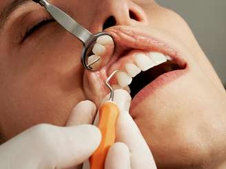 Dentes sendo examinados