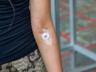 Adesivo de tatuagem indolor aplicado na pele