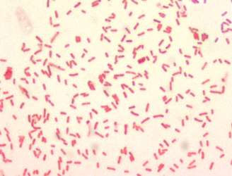 Sob uma ampliação de 1000X, imagem revela bactérias Yersinia pestis