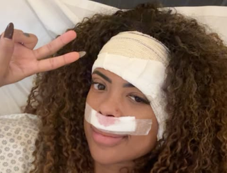 Marvvila conta com 2,7 milhões de seguidores no Instagram e compartilhou bastidores de seu processo de recuperação