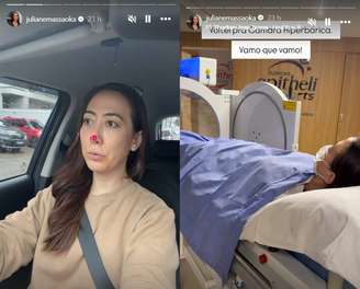 Juliane Massaoka atualiza os fãs sobre infecção causada pela injeção não autorizada de PMMA em rinoplastia