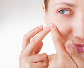 Medicamento isotretinoína derivado da vitamina A facilita o combate à acne severa num período que varia de seis a doze meses