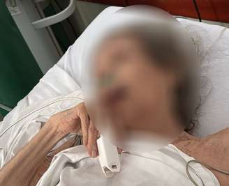 Idosa foi deixada aos cuidados do Cais frágil, com feridas e hematomas