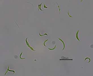Microalgas reduziram, em laboratório, a quantidade de antibióticos em uma amostra de água poluída.