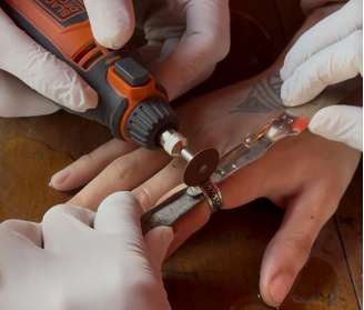 Ao menos três agentes do Corpo de Bombeiros participaram da remoção do anel