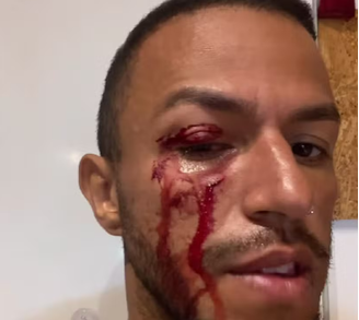 Brasileiro fez relato em suas redes sociais