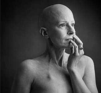 Liz O'Riordan foi diagnosticada com câncer de mama pela primeira vez em 2015