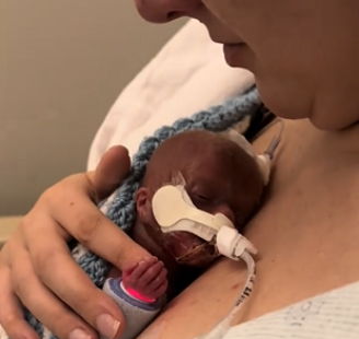 Sydney compartilhou o momento em que carregou seu bebê prematuro pela primeira vez