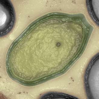 Pandoravírus tem genoma com 2,47 milhões de bases- mais do que muitos micro-organismos