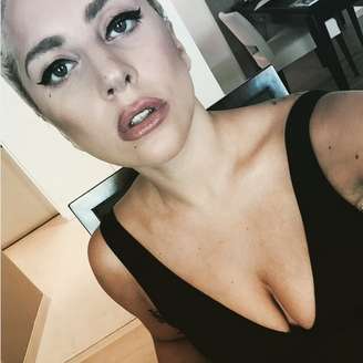 Lady Gaga mostra estrias em foto 