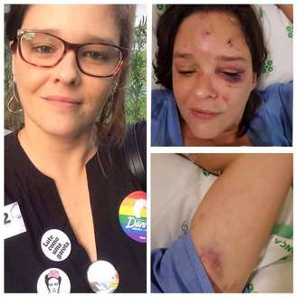 A vítima ficou com hematomas pelo rosto e teve um dos braços quebrados.