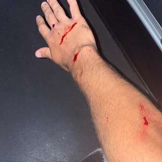 O meia Vinícius Locatelli ficou ferido após ataque