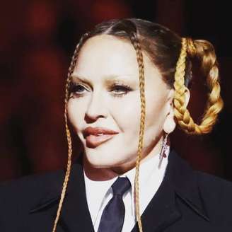 Apesar de Madonna alegar que as fotos clicadas dessa maneira distorcem a fisionomia de qualquer pessoa, o fato é que elas mostraram o que não pôde ser visto na transmissão do Grammy: o rosto da cantora