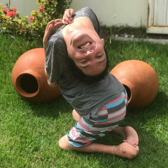 Claudio Vieira nasceu com Artrogripose Múltipla Congênita (AMC)